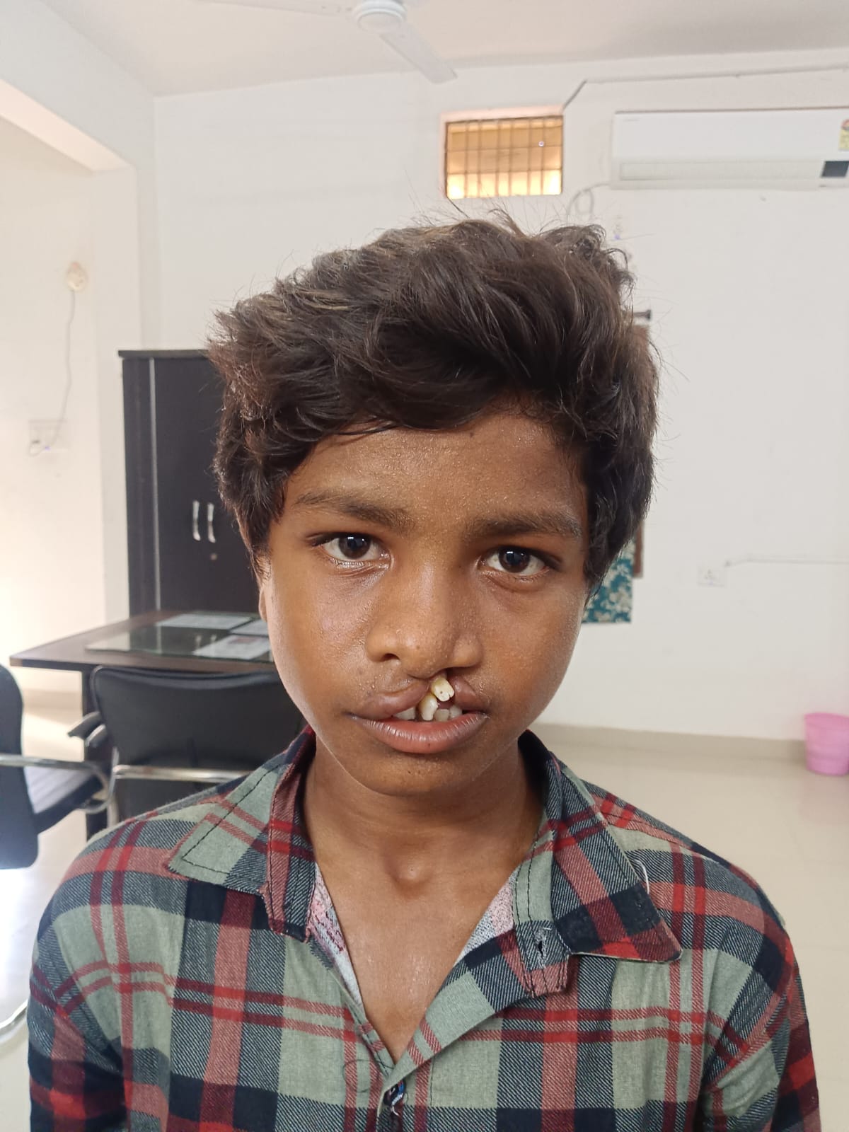 चिरायु’ दल ने लौटाई मुस्कान, जन्मजात कटे होंठ&hellip;